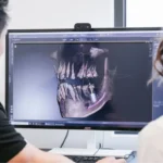 Dental-Implants-in-Smile-Lounge